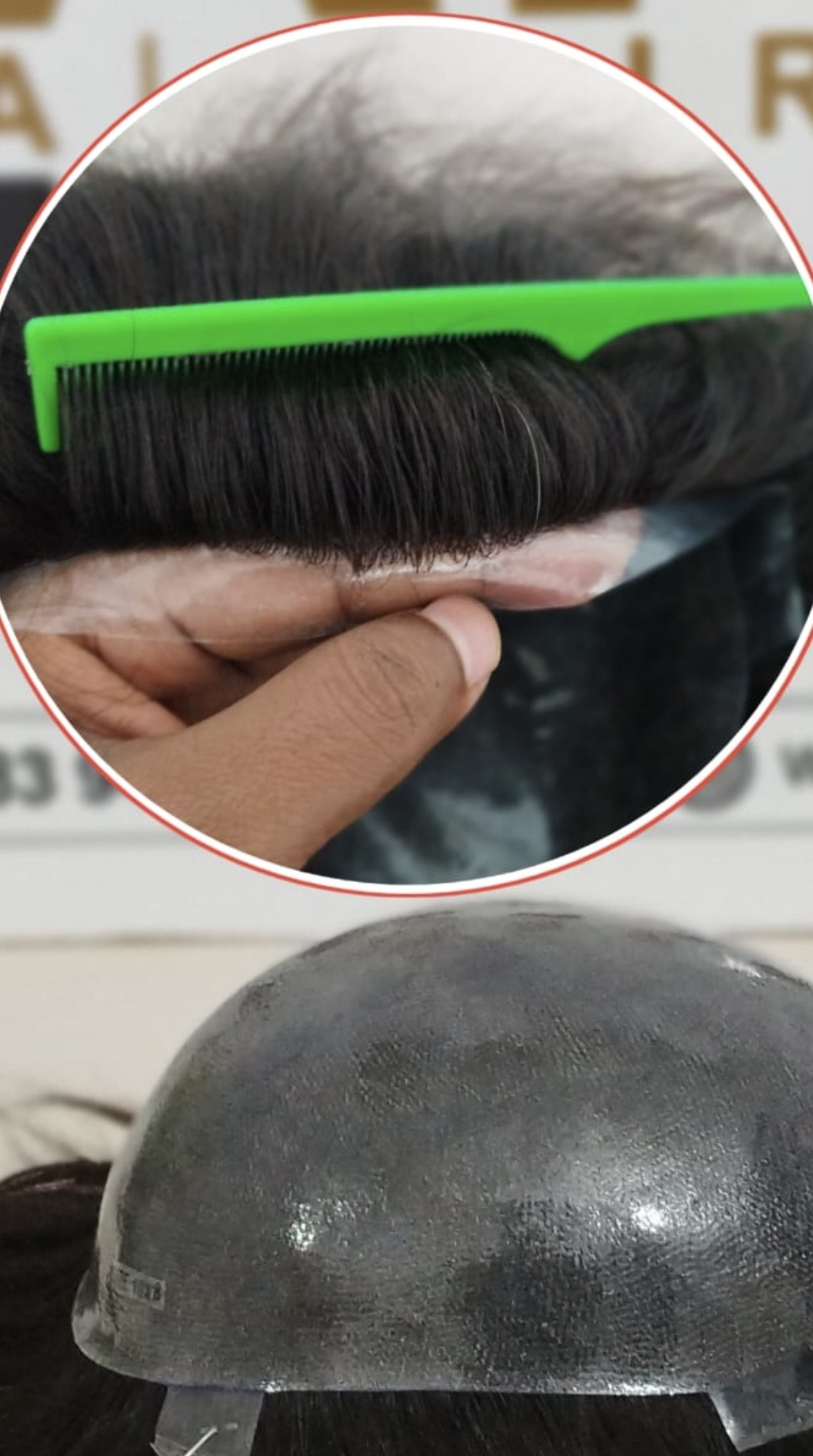 Natural hairline demonstration showing seamless integration